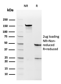 SDS-PAGE Analysis of Purified TYMS Recombinant Mouse Monoclonal Antibody (rTYMS/1884). Confirmation of Purity and Integrity of Antibody.