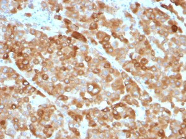 Tyrosinase (Melanoma Marker) Antibody