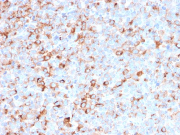 Tyrosinase (Melanoma Marker) Antibody - Image 2