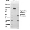 Tyrosinase (Melanoma Marker) Antibody - Image 2
