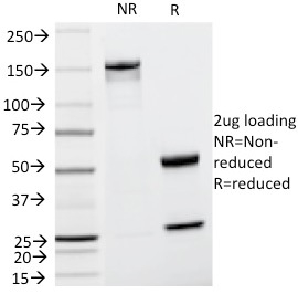 SDS-PAGE Analysis of Purified TYRP1 Mouse Monoclonal Antibody (TA99) Confirmation of Integrity and Purity of Antibody.