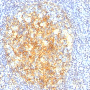 Formalin-fixed, paraffin-embedded human Tonsil stained with CD106 Monoclonal Antibody (VCAM1/843).