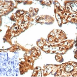 Formalin-fixed, paraffin-embedded human placenta stained with Vinculin Recombinant Rabbit Monoclonal Antibody (VCL/7091R) at 2ug/ml. Inset: PBS instead of primary antibody; secondary only negative control.
