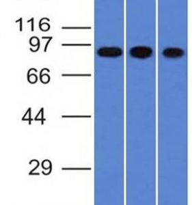 Western Blot of A549, HepG2 & HCT116 cell lysates with Villin Monoclonal Antibody (VIL1/1314).
