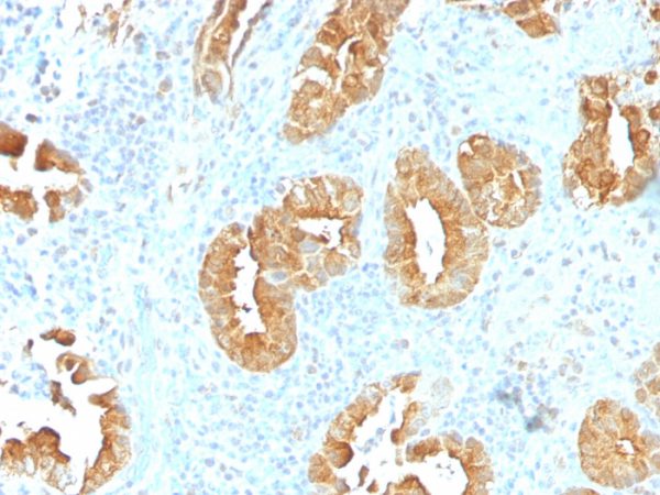 Villin (GI-Mucosal & Urogenital Brush Border Marker) Antibody - Image 2