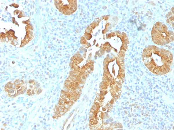 Formalin-fixed, paraffin-embedded human Rectum stained with Villin Mouse Monoclonal Antibody (VIL1/1325).