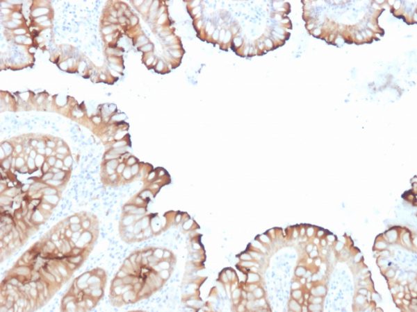 Villin (GI-Mucosal & Urogenital Brush Border Marker) Antibody - Image 2