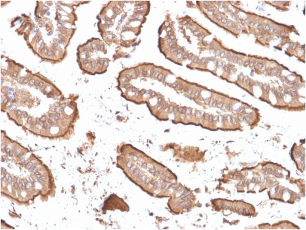 Recombinant Villin (GI-Mucosal & Urogenital Brush Border Marker) Antibody