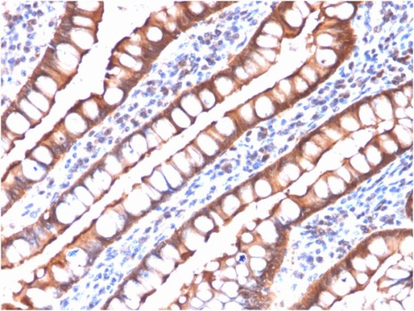 Recombinant Villin (GI-Mucosal & Urogenital Brush Border Marker) Antibody - Image 2