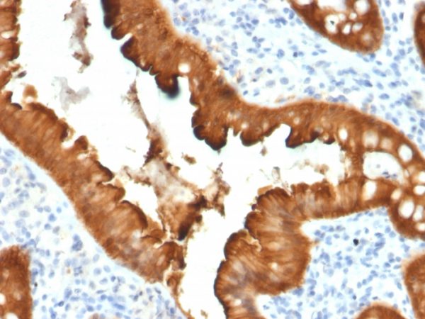 Villin (GI-Mucosal & Urogenital Brush Border Marker) Antibody