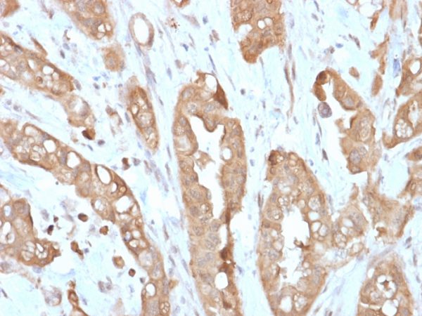 Recombinant Villin (GI-Mucosal & Urogenital Brush Border Marker) Antibody - Image 2