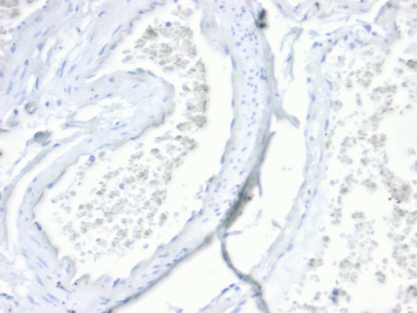 Recombinant Villin (GI-Mucosal & Urogenital Brush Border Marker) Antibody - Image 2