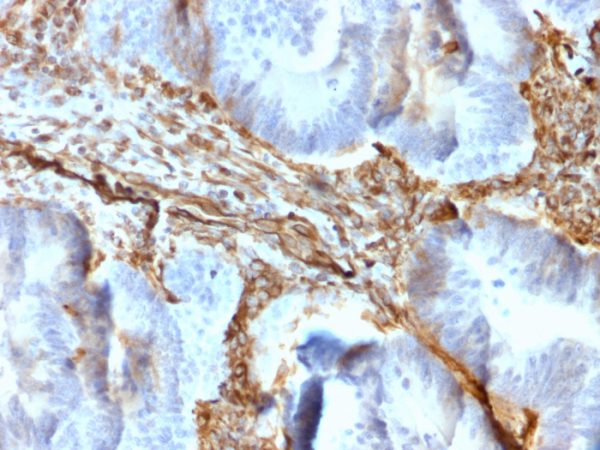 Recombinant Vimentin (Mesenchymal Cell Marker) Antibody - Image 2