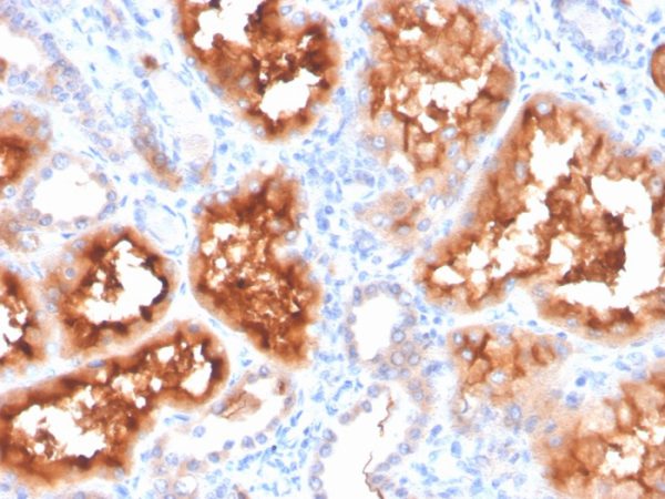 Formalin-fixed, paraffin-embedded human kidney stained with CAIX-Monospecific Mouse Monoclonal Antibody (CA9/3407).