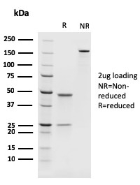 SDS-PAGE Analysis of Purified PAX8 Recombinant Mouse Monoclonal Antibody (rPAX8/1492). Confirmation of Purity and Integrity of Antibody.