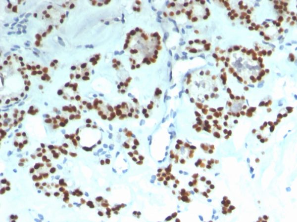 Recombinant PAX8 (Renal Cell Marker) Antibody - Image 2