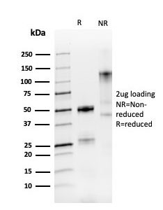 SDS-PAGE Analysis of Purified PAX8 Recombinant Rabbit Monoclonal Antibody (PAX8/3688R). Confirmation of Purity and Integrity of Antibody.