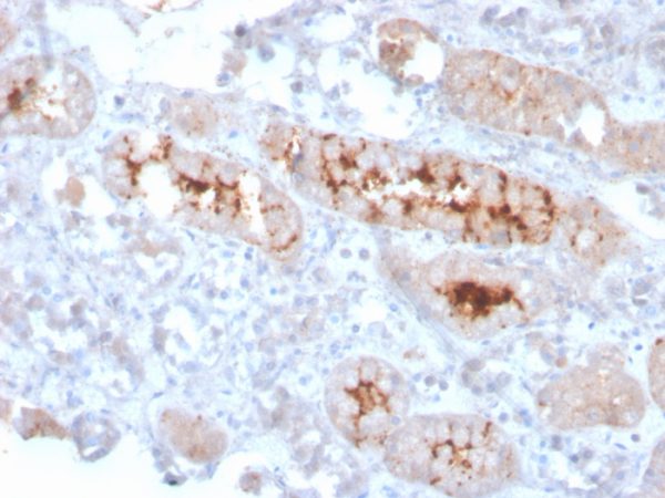 Formalin-fixed, paraffin-embedded human kidney stained with FGF23 Mouse Monoclonal Antibody (FGF23/4166).