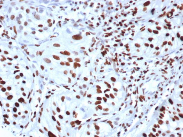 Formalin-fixed, paraffin-embedded human bladder stained with Histone H3 (PHH3) Recombinant Mouse Monoclonal Antibody (rPHH3/6824).