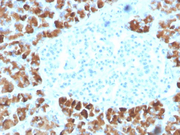 Insulinoma Associated 2 / INSM2 Antibody