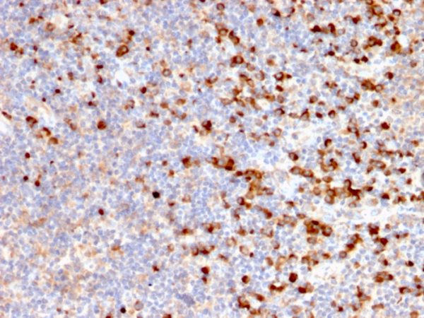 Formalin-fixed, paraffin-embedded human Tonsil stained with TIM3 Mouse Monoclonal Antibody (TIM3/2399).