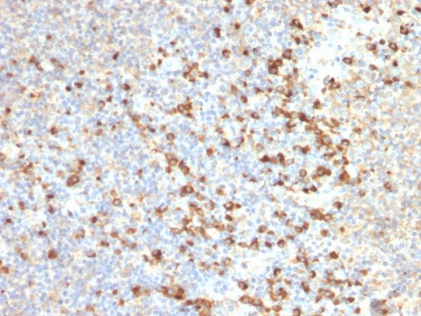 Formalin-fixed, paraffin-embedded human Tonsil stained with TIM3 Mouse Monoclonal Antibody (TIM3/2399).