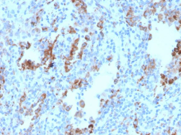 TIM3 / HAVCR2 / CD366 (Effector T-Cell Marker) Antibody