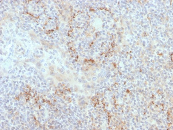 TIM3 / HAVCR2 / CD366 (Effector T-Cell Marker) Antibody - Image 2