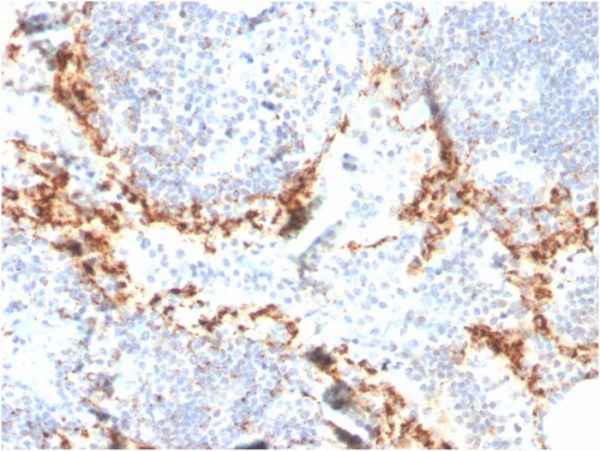 Formalin-fixed, paraffin-embedded human lymph node stained with TIM3 Mouse Monoclonal Antibody (TIM3/4024).