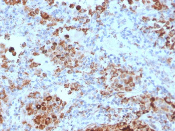 Formalin-fixed, paraffin-embedded human lymph node stained with TIM3 Mouse Monoclonal Antibody (TIM3/4028).