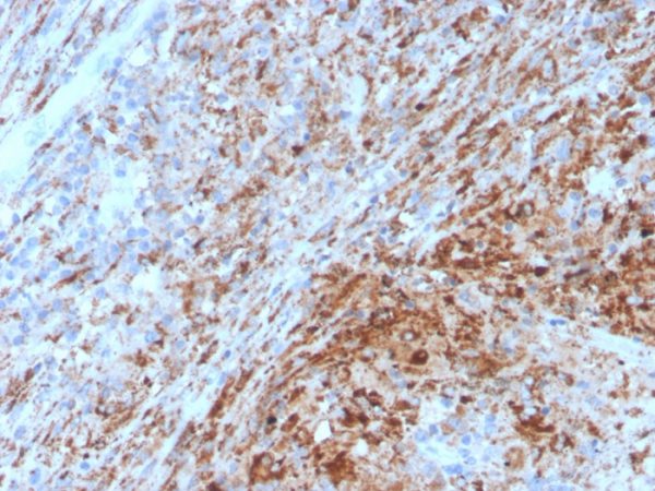 Formalin-fixed, paraffin-embedded human lymph node stained with TIM3 Mouse Monoclonal Antibody (TIM3/4029).