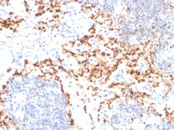 Formalin-fixed, paraffin-embedded human tonsil stained with TIM3 Mouse Monoclonal Antibody (TIM3/4029).