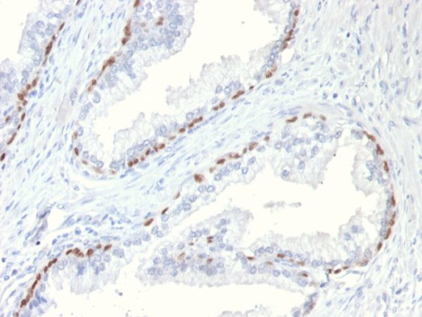 Formalin-fixed, paraffin-embedded Mouse Prostate stained with p63 Mouse Monoclonal Antibody (TP63/11).