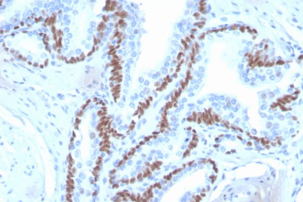 Formalin-fixed, paraffin-embedded human skin stained with  p40 Recombinant Rabbit Monoclonal Antibody (ZR8).