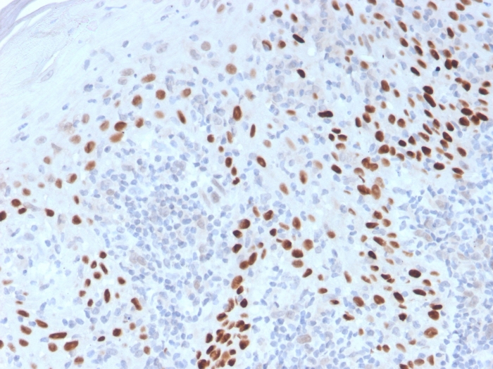 p40 (deltaNp63) (Squamous, Basal & Myoepithelial Cell Marker) Antibody ...