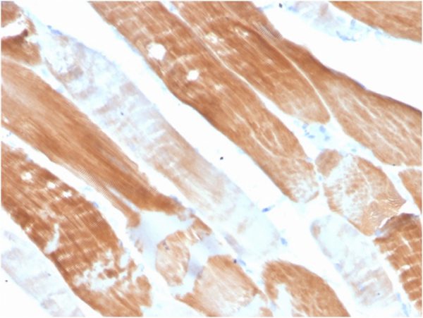 Sarcomeric Actinin Alpha 2 / ACTN2 Antibody