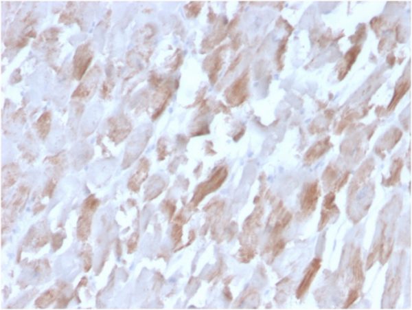 Sarcomeric Actinin Alpha 2 / ACTN2 Antibody - Image 3