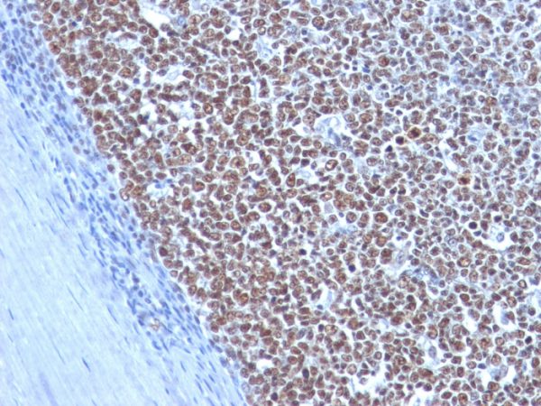 Formalin-fixed, paraffin-embedded human Tonsil stained with Cyclin B1 Mouse Monoclonal Antibody (CCNB1/1098).