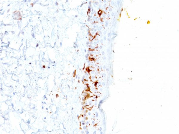 Formalin-fixed, paraffin-embedded human Skin stained with CD1a Mouse Monoclonal Antibody (C1A/711).