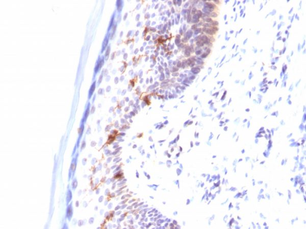 Formalin-fixed, paraffin-embedded human Skin stained with CD1a Mouse Monoclonal Antibody (C1A/711).