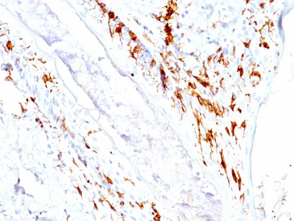 Formalin-fixed, paraffin-embedded human Skin stained with CD1a Monoclonal Antibody (O10+C1A/711).