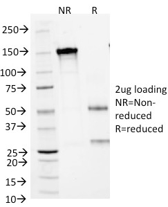 SDS-PAGE Analysis of Purified CD1a Mouse Monoclonal Antibody (66IIC7). Confirmation of Integrity and Purity of Antibody.