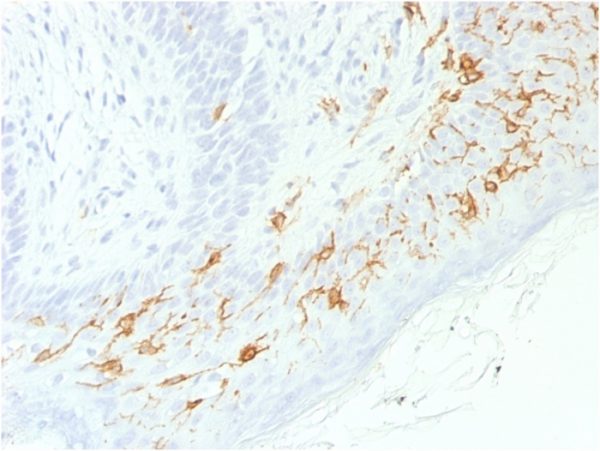 Formalin-fixed, paraffin-embedded human Skin stained with CD1a-Monospecific RecombinantRabbit Monoclonal Antibody (C1A/1506R).