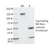 CD2 / Lymphocyte Function Antigen 2 (LFA-2) Antibody - Image 3