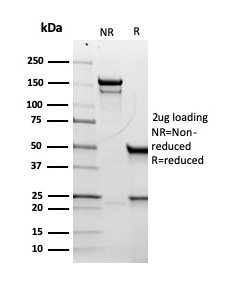 SDS-PAGE Analysis of Purified CD5 Recombinant Mouse Monoclonal Antibody (rC5/6429). Confirmation of Purity and Integrity of Antibody.