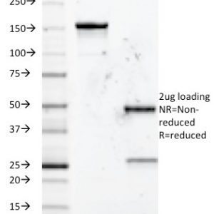 SDS-PAGE Analysis of Purified CD5 Mouse Monoclonal Antibody (Clone B-B8). Confirmation of Integrity and Purity of Antibody.
