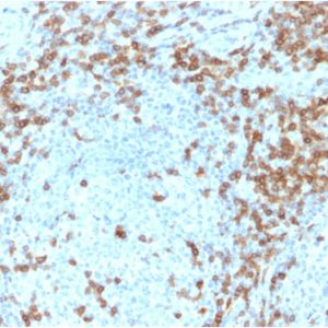 Formalin-fixed, paraffin-embedded human tonsil stained with CD5-Monospecific Mouse Monoclonal Antibody (CD5/2418). HIER: Tris/EDTA, pH9.0, 45min. 2°C: HRP-polymer, 30min. DAB, 5min.