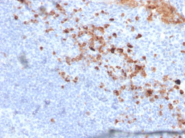 CD5L / CD5LG / CD5 Ligand Antibody - Image 2