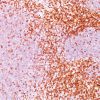 CD6 (Negative Marker of T-regulatory Cells) Antibody