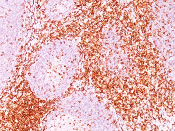 CD6 (Negative Marker of T-regulatory Cells) Antibody - Image 2